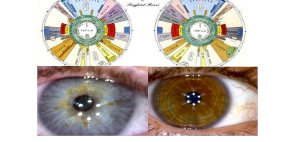 Scopri di più sull'articolo Capire le nostre priorità attraverso l’iridologia